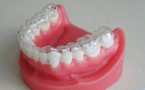 烟台牙齿隐形矫正的基本流程