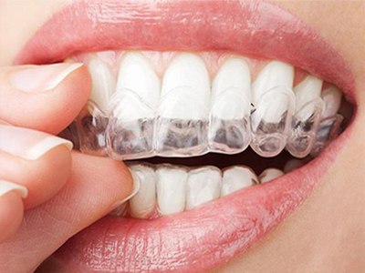 烟台口腔--牙齿矫正的误区