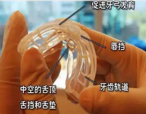 儿童牙齿肌功能矫正有必要吗