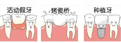 烟台种植牙能使用多长时间